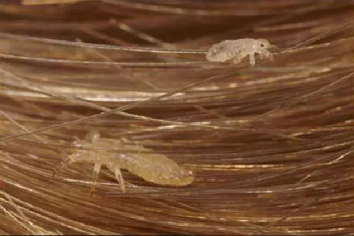 Piojos Pediculus humanus