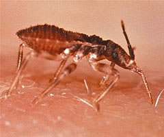 La enfermedad de Chagas en Europa